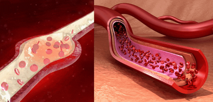 Nooro EMS Foot Massager blood circulation